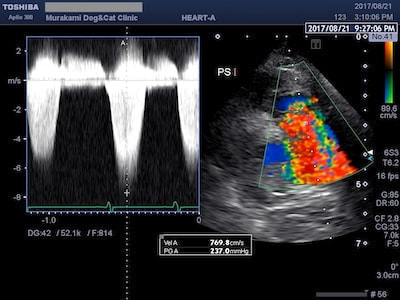 肺動脈狭窄症のエコー写真
