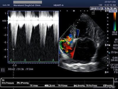 三尖弁閉鎖不全症のエコー写真