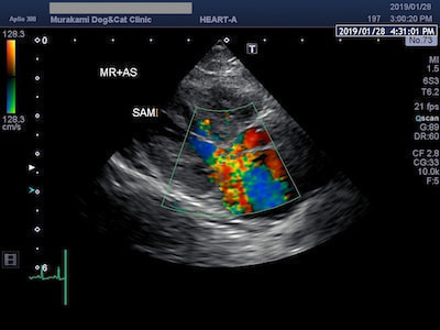 SAMによるMR&ASのエコー写真