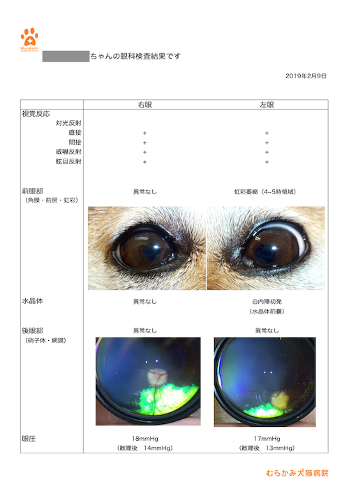 眼科検査結果見本