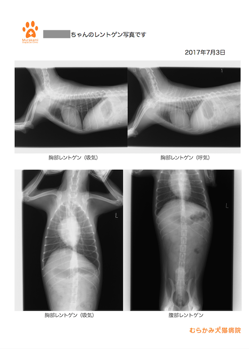 レントゲン検査結果見本１