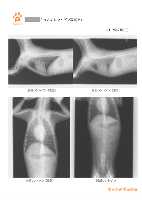 レントゲン検査結果見本１