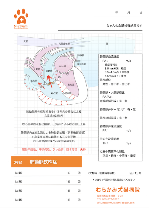 肺動脈狭窄症