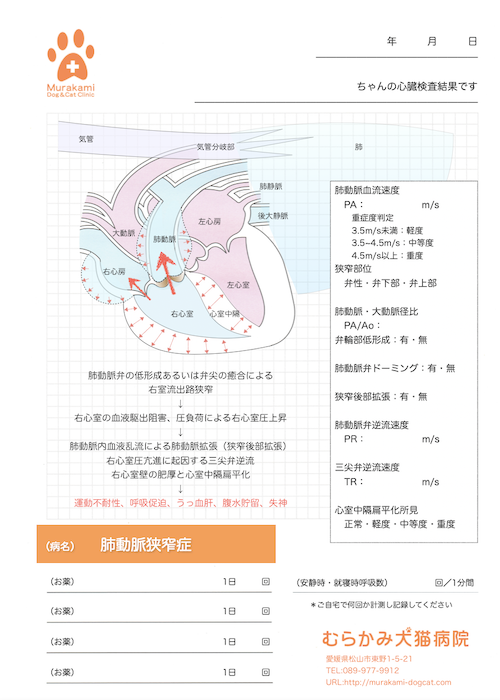 肺動脈狭窄症