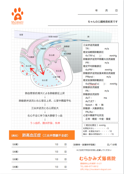 肺高血圧症
