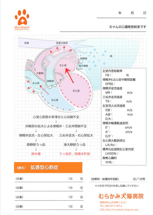 拡張型心筋症