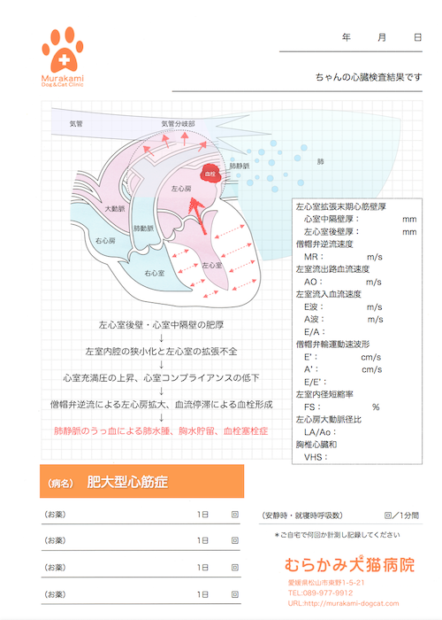 肥大型心筋症