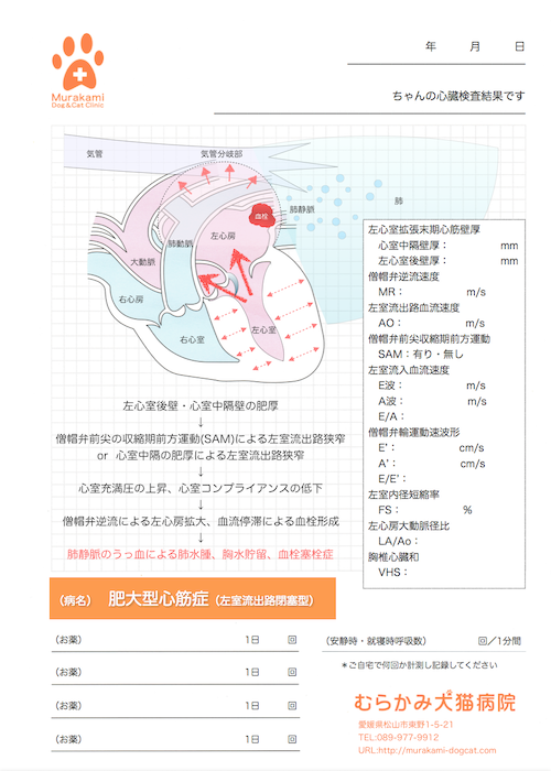 肥大型心筋症（左室流出路閉塞型）