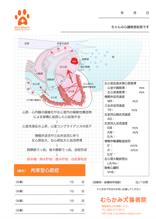 拘束型心筋症