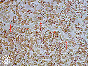 フィラリア症の血液顕微鏡検査